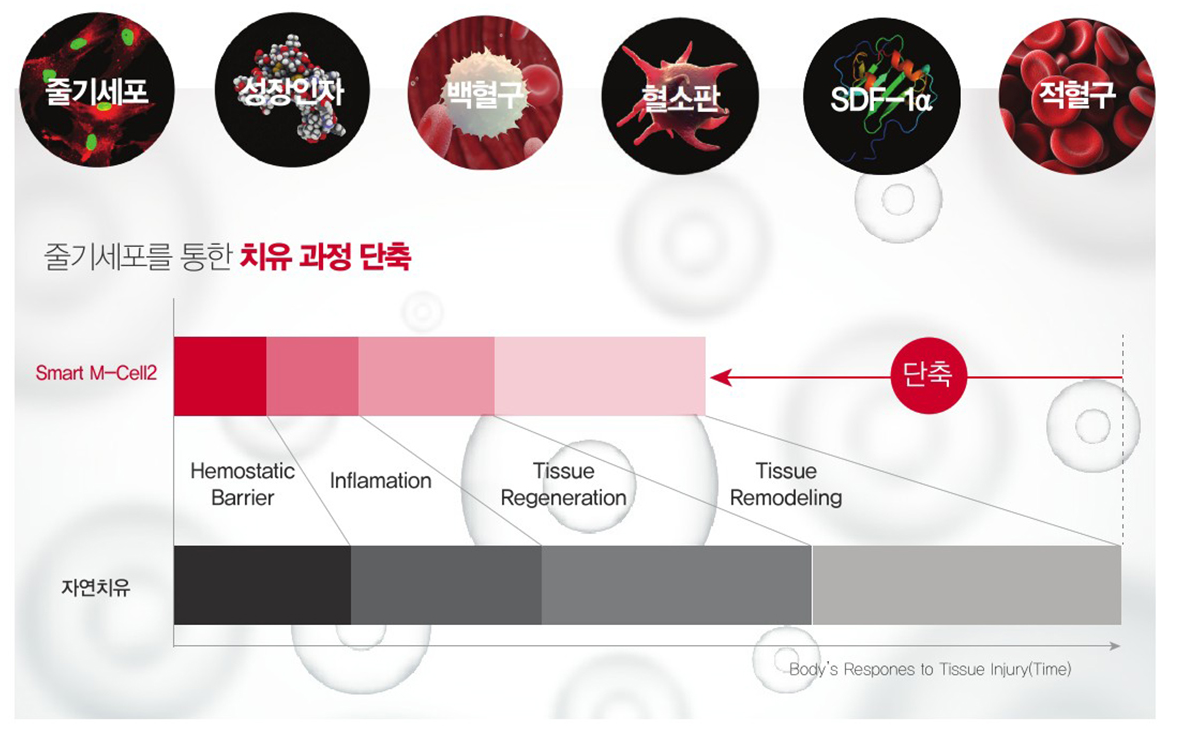 미라셀만의 줄기세포 기술력